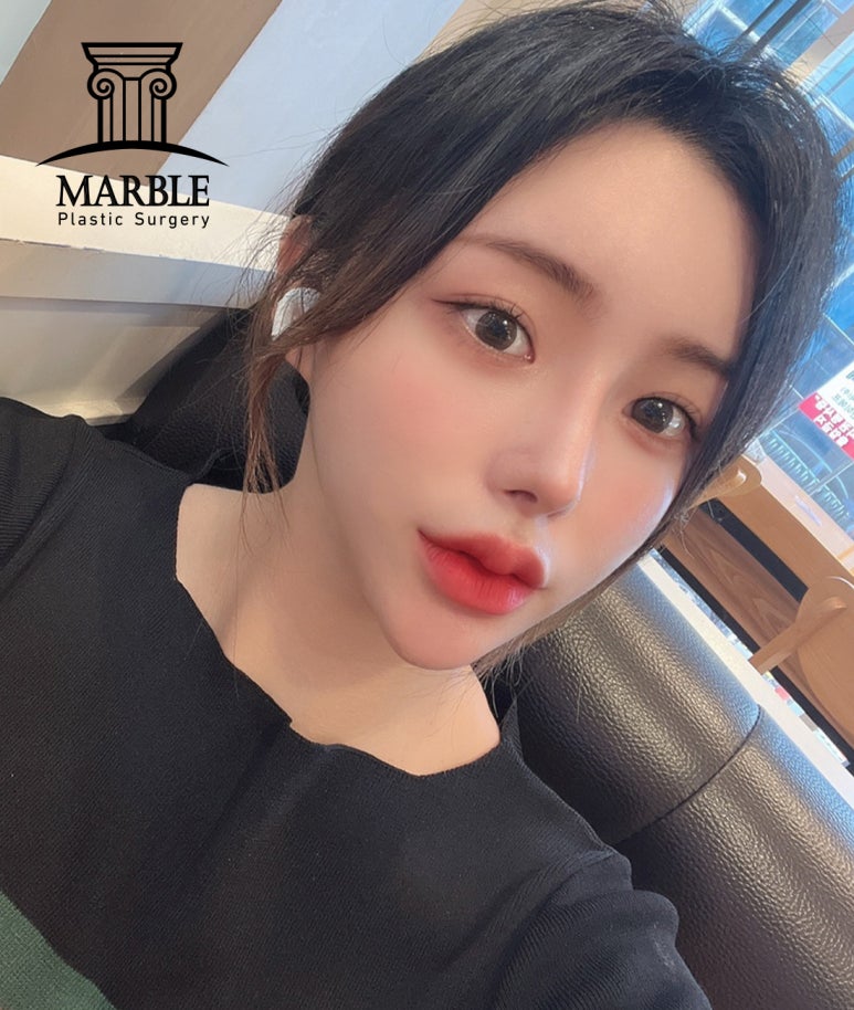 눈재수술 더 신중하게 고민해서 관련 이미지 5