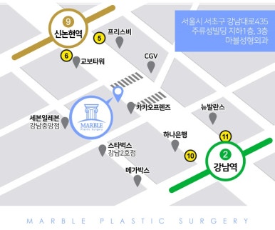 눈재수술비용 및 고려할 점 관련 이미지 7