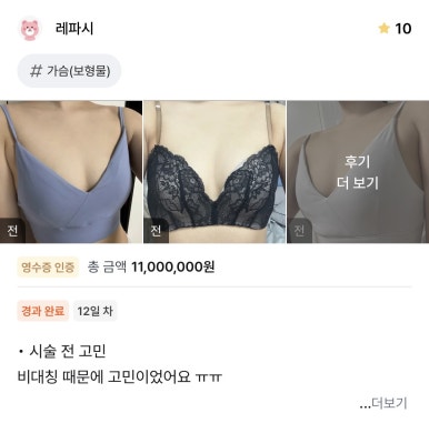 [강남성형외과 가슴수술 리얼후기] 짝가슴이 고민이었는데 55cc차이도 완벽하게 맞춰 인생가슴 찾았어요! 관련 이미지 1