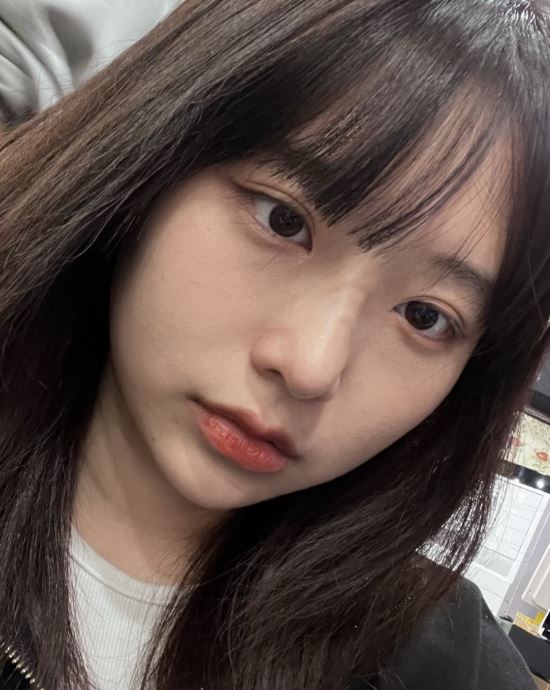 자연유착 쌍꺼풀 인기 많은 이유? 관련 이미지 2
