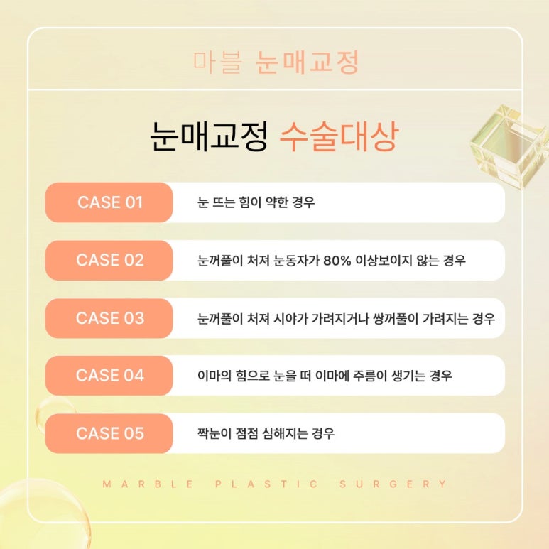 남자눈매교정가격, 잘 알아보고 결정 관련 이미지 4