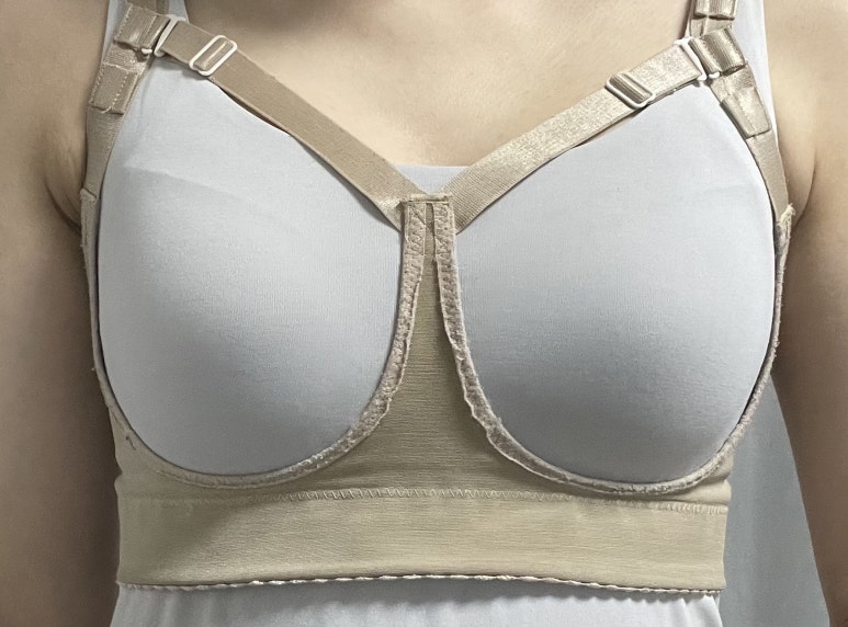One-Month Real Review After Breast Augmentation ｜ From Right After Surgery to the Changes Over Time image 12