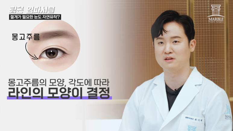 자연유착쌍꺼풀 팩트체크! 마블성형외과의원 관련 이미지 3