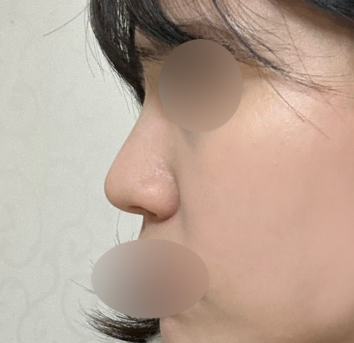 복코수술비용, 정확하게 찾아봐야 하는 이유 관련 이미지 1
