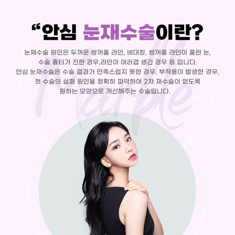 눈재수술 안정적이고 확실하게! 관련 이미지 2
