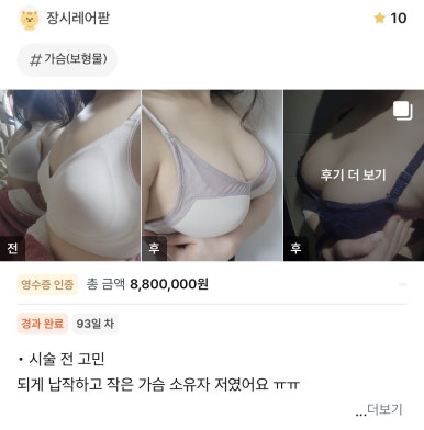 [Gangnam Plastic Surgery Breast Augmentation Review] The Stress of Having a Small, Flat Chest… I Met Dr. Seo Il-beom and Became Naturally Beautiful! image 1
