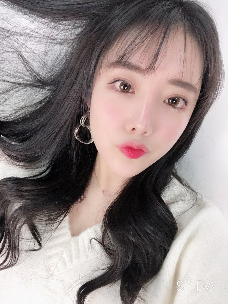 눈트임성형 얼굴의 밸런스를 생각하여 관련 이미지 7
