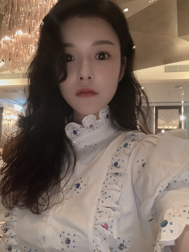 비절개눈매교정 자연스럽게 교정 관련 이미지 5