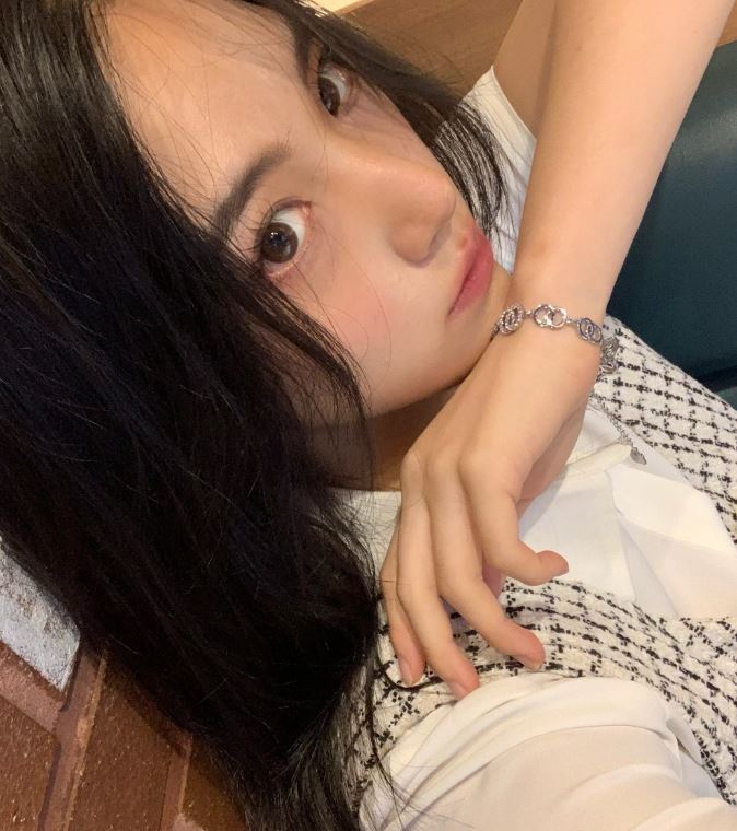 쌍꺼풀풀림 왜 풀리는지 해결 방법은 무엇일까? 관련 이미지 4