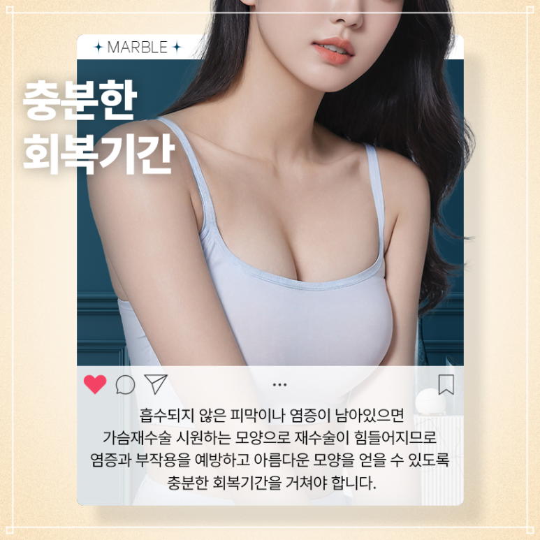모티바가슴재수술 만족도 높은 강남성형외과 찾는다면｜마블성형외과의원 관련 이미지 10