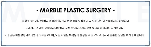 첫쌍수 리얼상세후기 마블 관련 이미지 31
