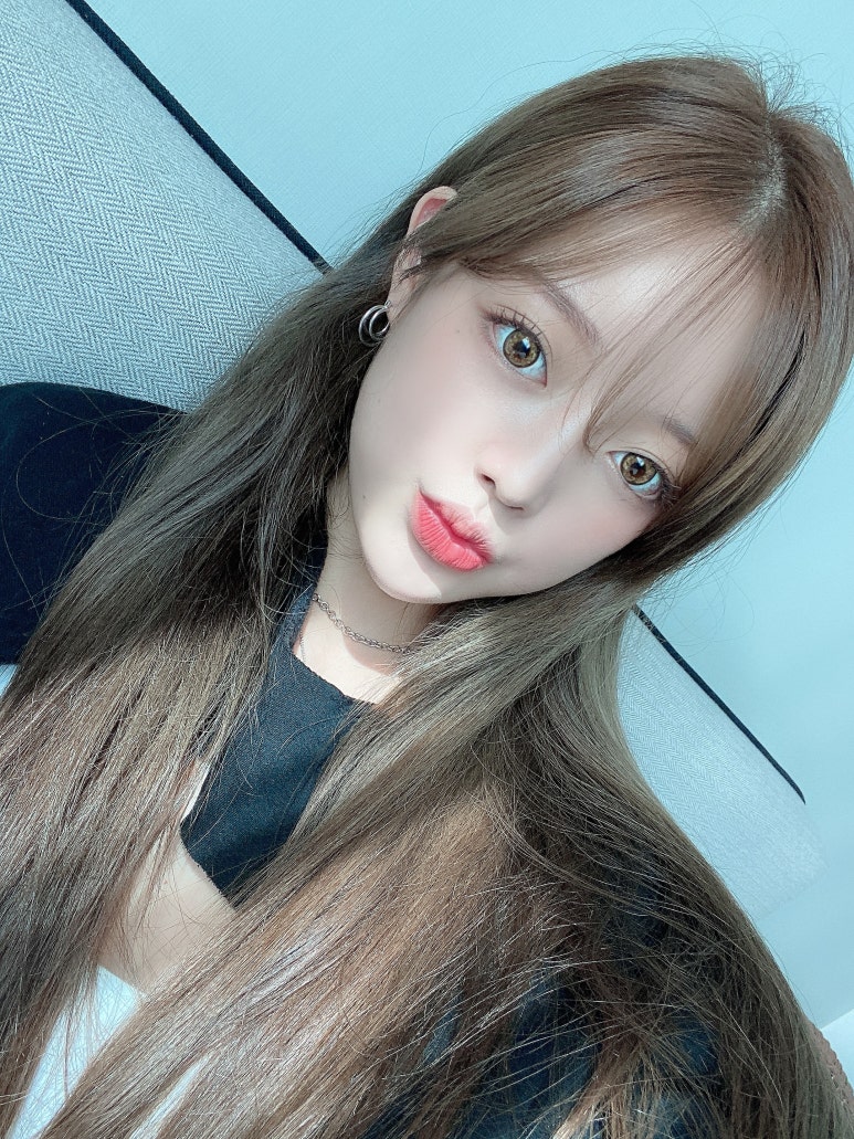 눈밑지방재배치수술후 화사하게 마블성형외과의원 관련 이미지 7