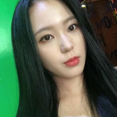 소세지눈재수술 자연스럽게 되고 싶어! 관련 이미지 8