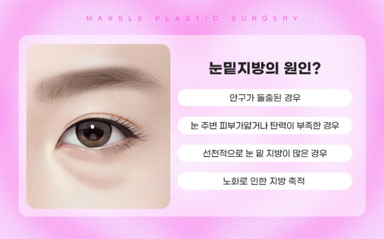 눈밑지방재배치수술후 성공적인 변화 마블성형외과 관련 이미지 5