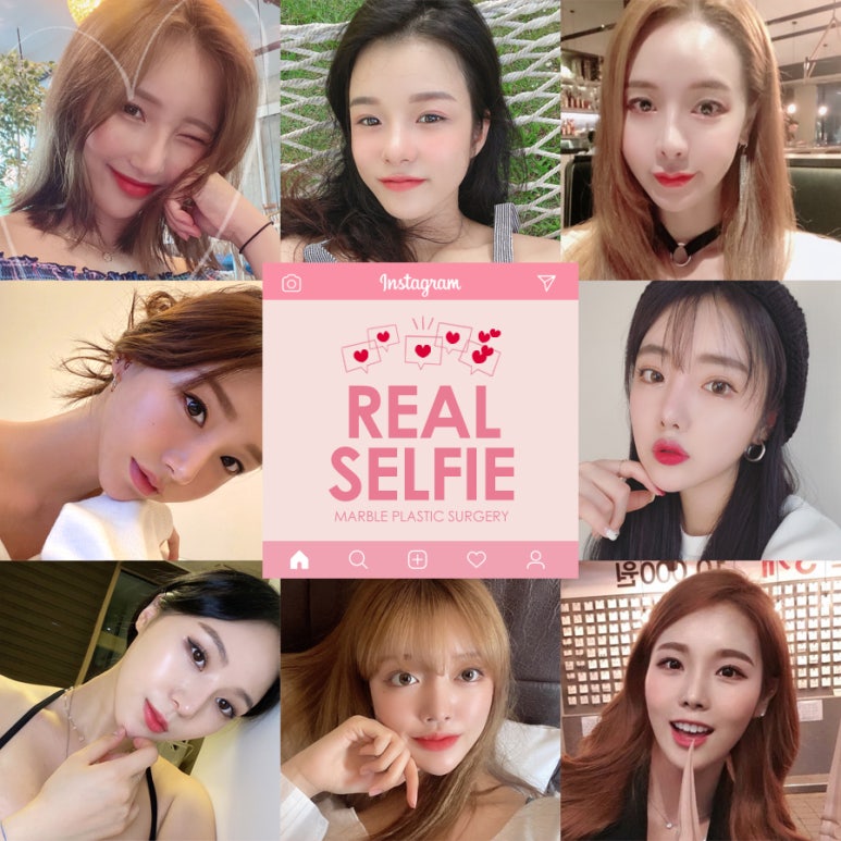 안검하수수술비용 부담되시나요? 관련 이미지 8