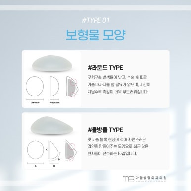 가슴성형재수술 언제 받아야 할까? 실패 원인부터 시기까지｜마블성형외과 관련 이미지 4