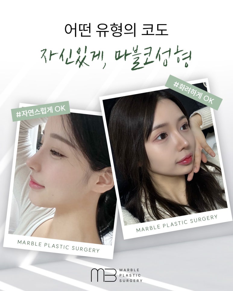 수험생 코성형, 방학동안 안전하게 준비하는 방법 관련 이미지 3