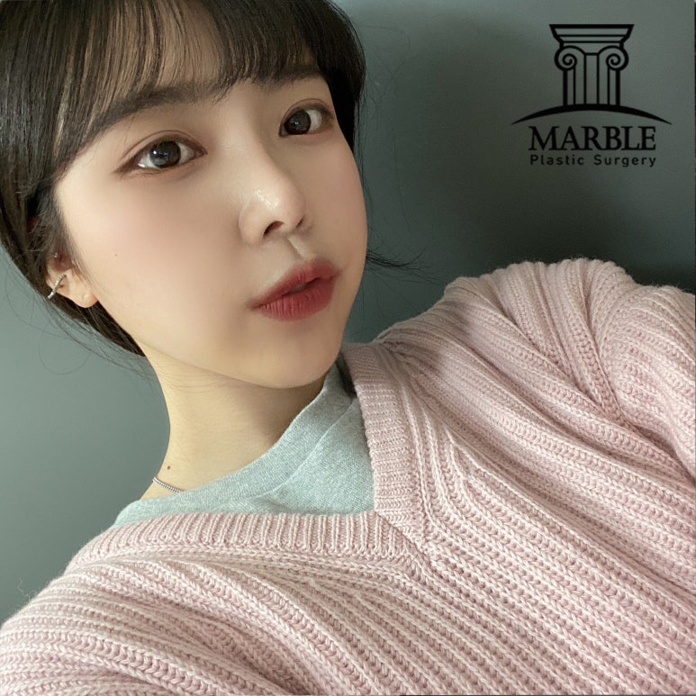 강남성형외과 나에게 맞는 눈성형을 해야 하는 이유 관련 이미지 3