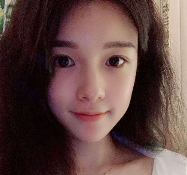 자연유착 쌍꺼풀 자연스럽게!! 관련 이미지 4