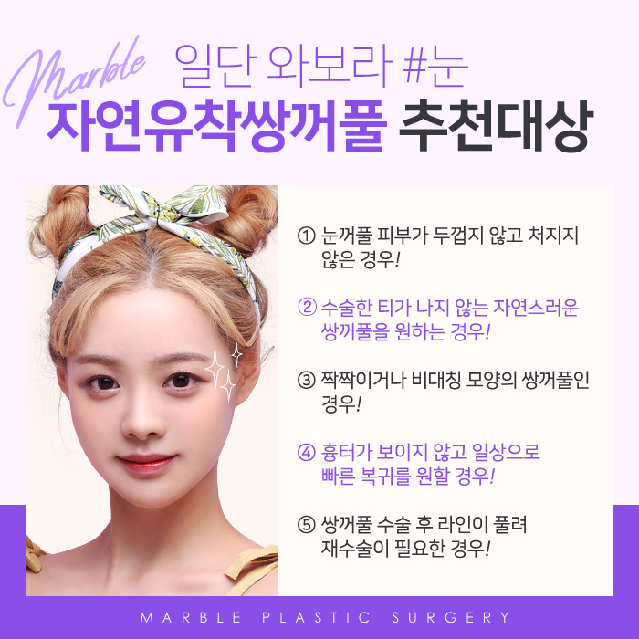 쌍꺼풀수술전후 내추럴한 인상으로 거듭나!마블성형외과의원 관련 이미지 4