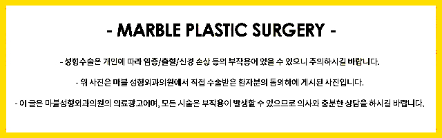 쌍수절개법 자연스러움을 더하다! 마블성형외과 관련 이미지 7