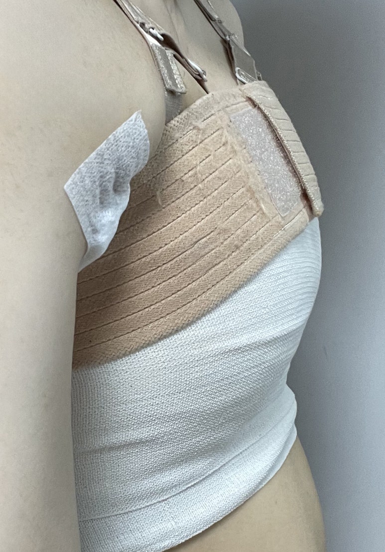 One-Month Real Review After Breast Augmentation ｜ From Right After Surgery to the Changes Over Time image 6