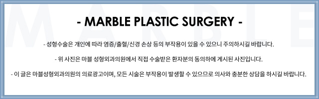 쌍수재수술잘하는곳 비용보다 원인분석이 중요 관련 이미지 11