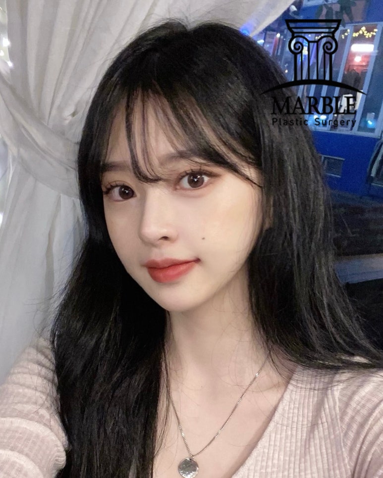 쌍꺼풀수술후기, 자연스러운 변화는 마블성형외과의원! 관련 이미지 4
