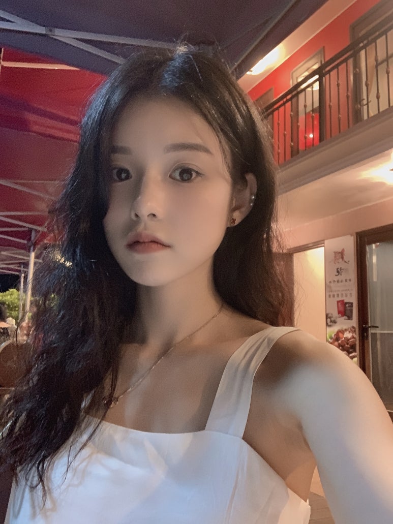 강남눈성형 자연스럽고 예쁜 라인 관련 이미지 6