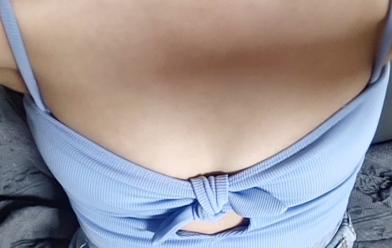 가슴확대술 비용, 종류별로 차이가 나는 이유 관련 이미지 1