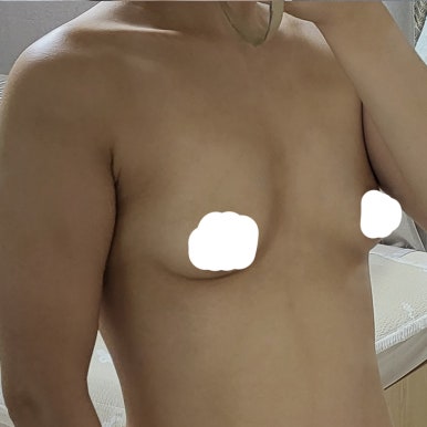[강남성형외과 가슴확대수술 후기] 옷 태 안 살던 밋밋한 실루엣.. 서일범원장님 만나 워너비 라인됐어요! 관련 이미지 4