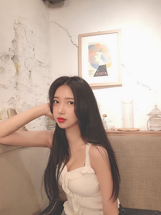 이중턱없애기 아큐스컬프로 효과 있을까? 마블성형외과의원 관련 이미지 5
