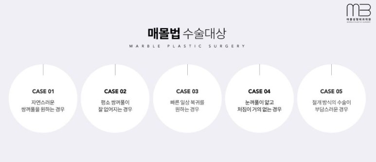 첫쌍수 리얼상세후기 마블 관련 이미지 9