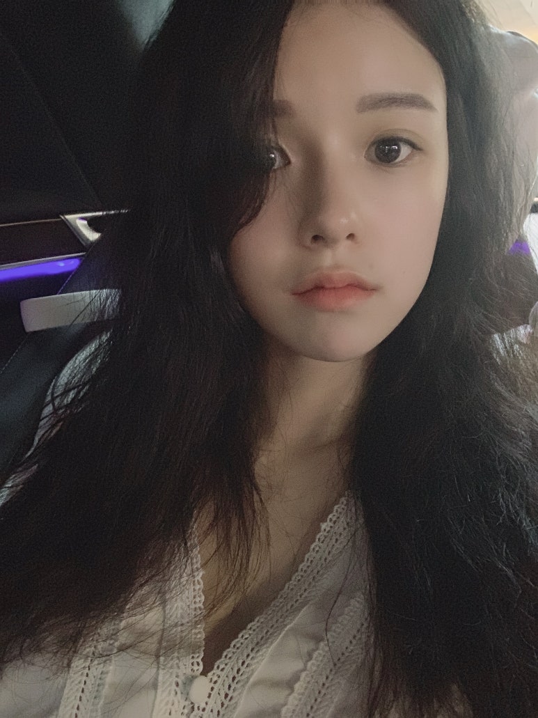 쌍꺼풀재수술 꼼꼼하고 신중하게 결정 관련 이미지 1