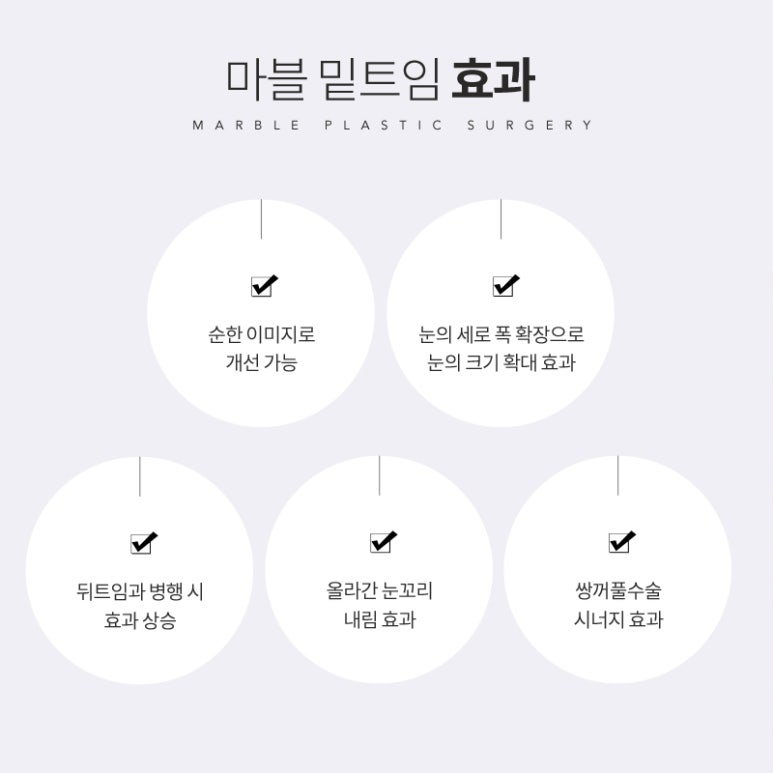 밑트임전후 색다르게 눈매 변화! 마블성형외과의원 관련 이미지 4