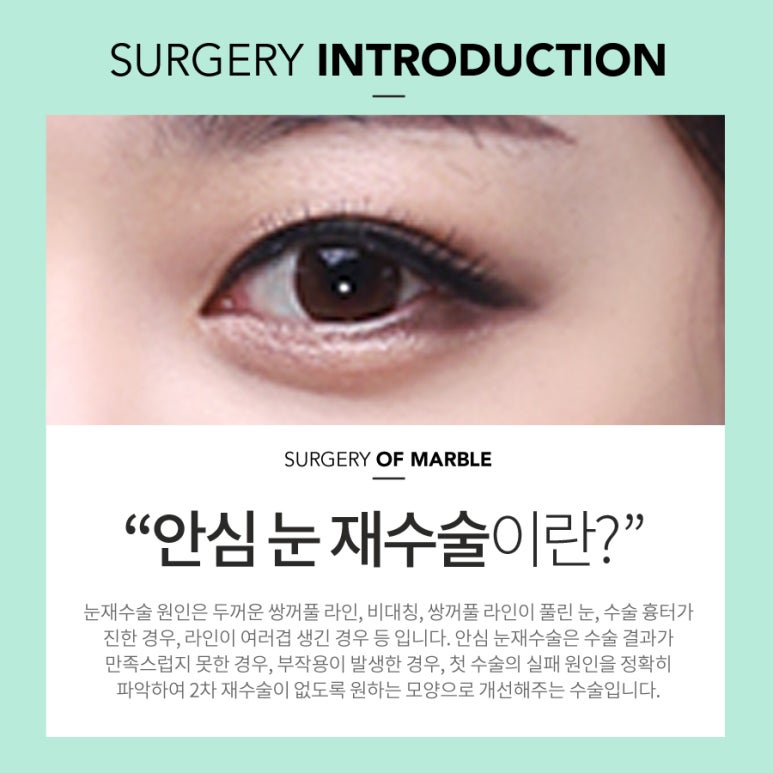 소세지눈재수술 자연스럽게 되고 싶어! 관련 이미지 2