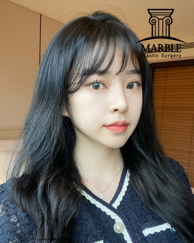 쌍꺼풀수술후기, 자연스러운 변화는 마블성형외과의원! 관련 이미지 3