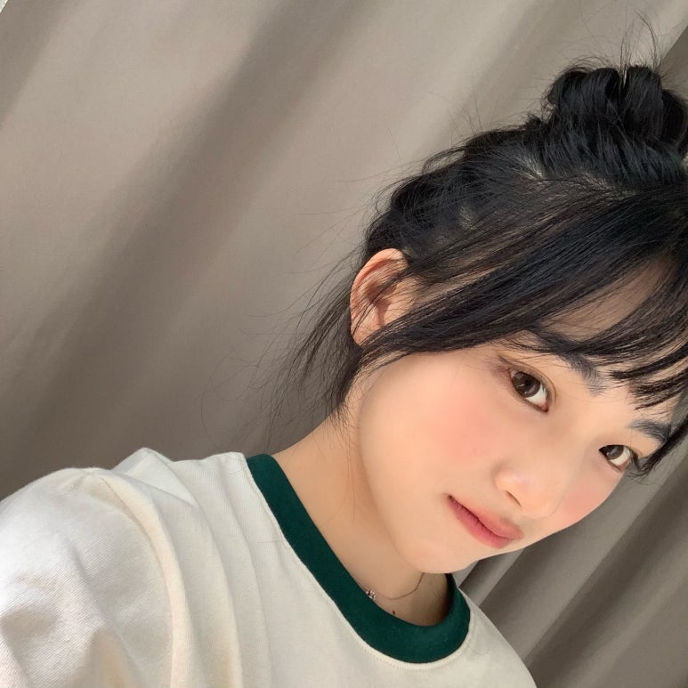 쌍꺼풀재수술 더 이상의 반복은 없다 관련 이미지 8
