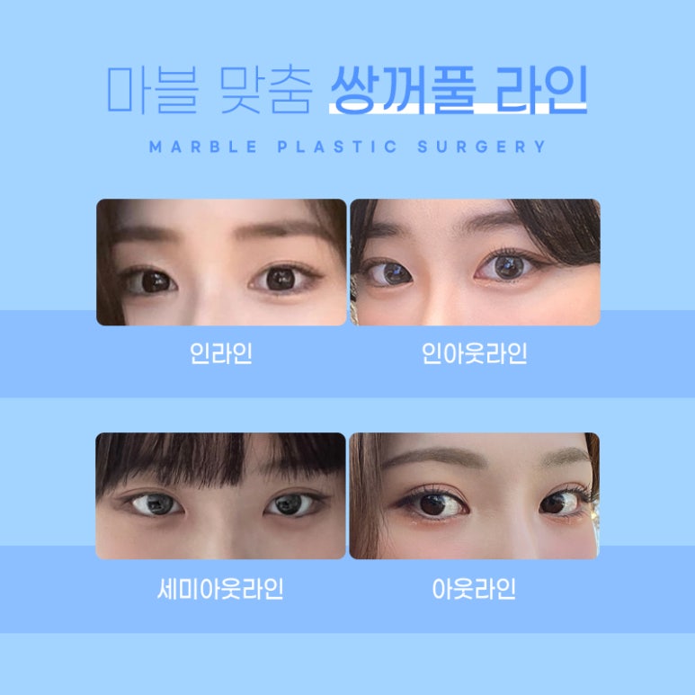 자연유착후기 기대와 현실적인 결과 관련 이미지 2
