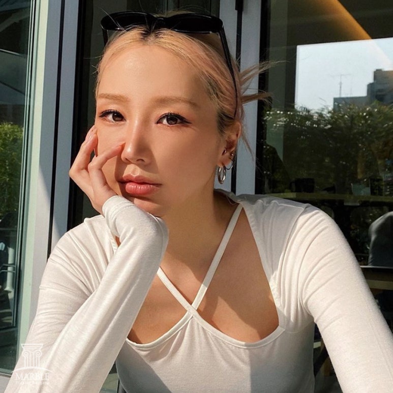 쌍수라인 실밥제거후 두갈래로 잡힌 경우 마블성형외과의원 관련 이미지 1