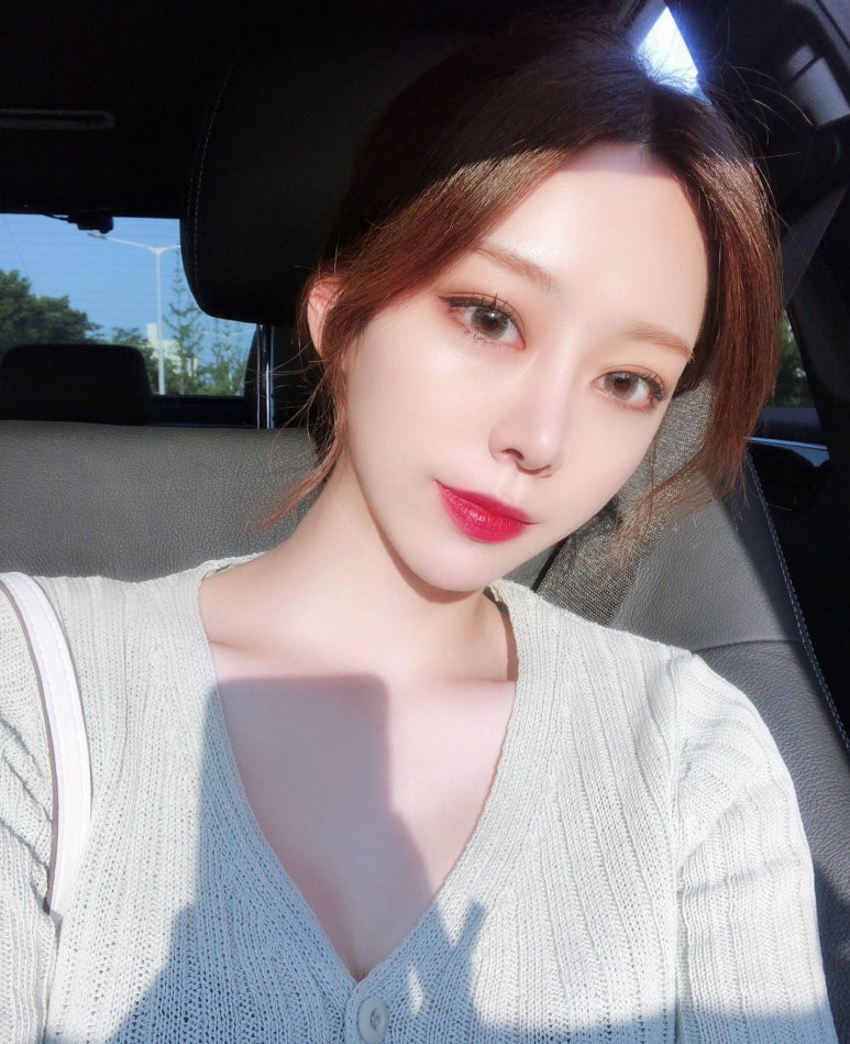 눈매교정 또렷하고 시원한 눈매로! 마블성형외과의원 관련 이미지 3