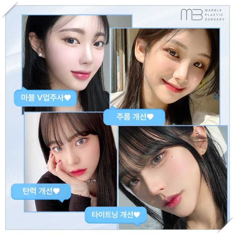 마블성형외과의 V업주사 (브이업주사), 왜 특별할까? (전후사진O) 관련 이미지 8