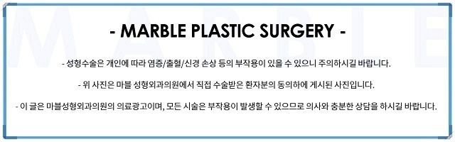 남자눈매교정가격, 잘 알아보고 결정 관련 이미지 17