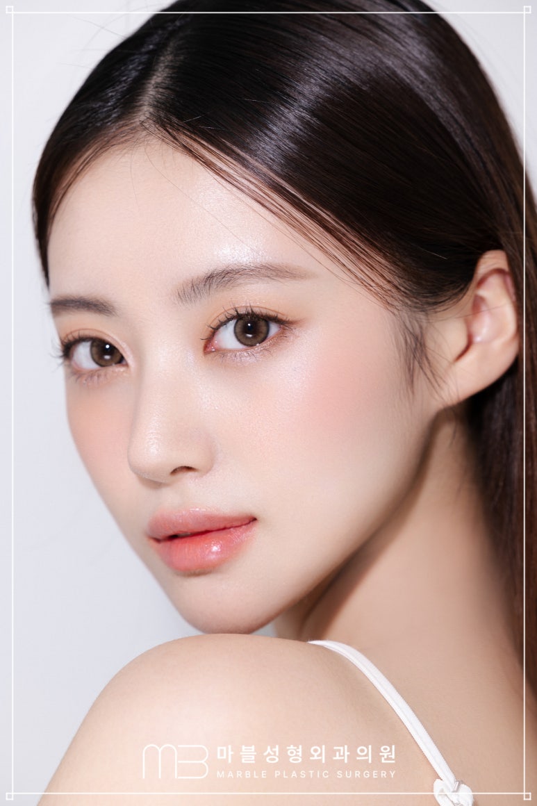 강남실리프팅 추천 대상&middot;부위&middot;효과는? 마블성형외과의원 총정리 관련 이미지 5