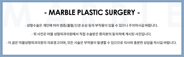 강남역 고등학생눈매교정잘하는곳, 시술방법, 장점, 필요성 관련 이미지 15
