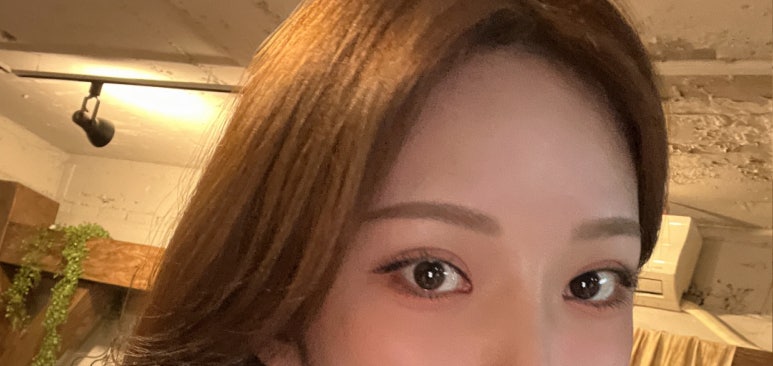 쌍수풀림 처음부터 신중하게 하면 걱정 없이 관련 이미지 3