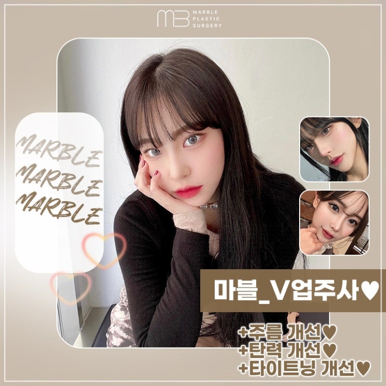 마블성형외과 V업주사가 특별한 이유! 관련 이미지 6