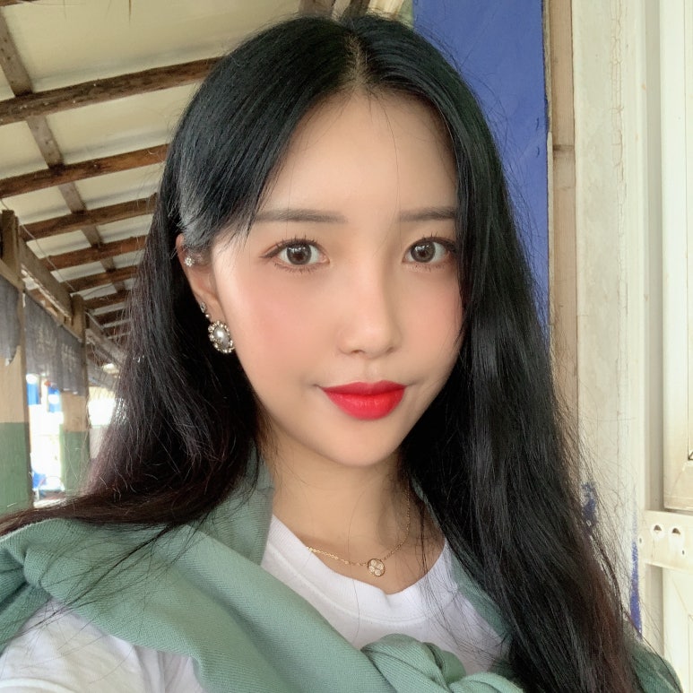 뒤트임가격 원하던 눈매로 변화 관련 이미지 4