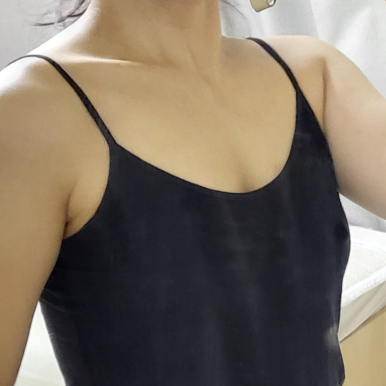 [강남성형외과 가슴수술 후기] 고민한 시간이 아까울 정도.. 서일범 원장님 만나고 워너비 라인 성공ㅎㅎ 관련 이미지 3