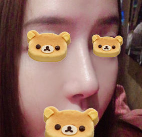 [강남역성형외과 매부리코수술 후기] 코재수술이라 진짜 무서웠는데 매부리코, 복코교정 한번에 해결 됐어요! 관련 이미지 5